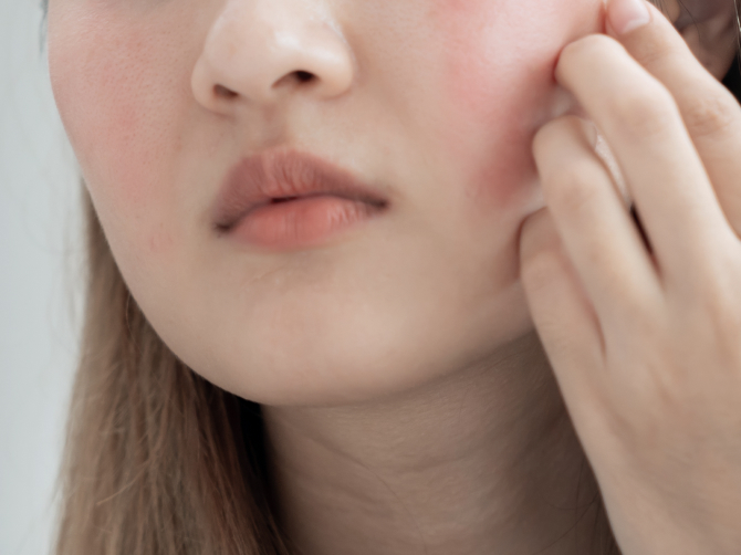 갱년기 주요증상