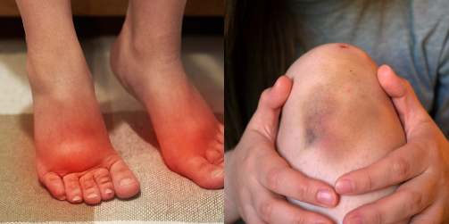 한방관점의 주요 통증 원인과 증상