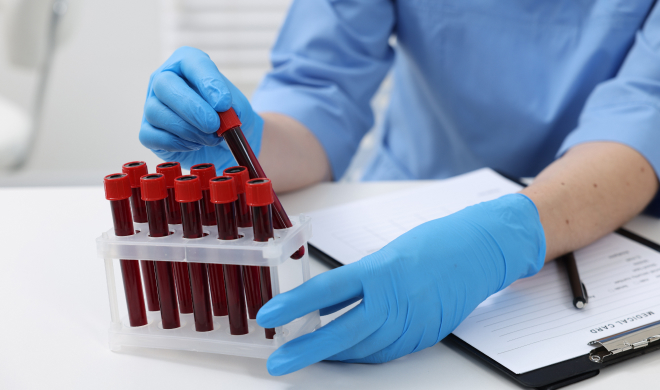 수액치료 전 검사 프로그램