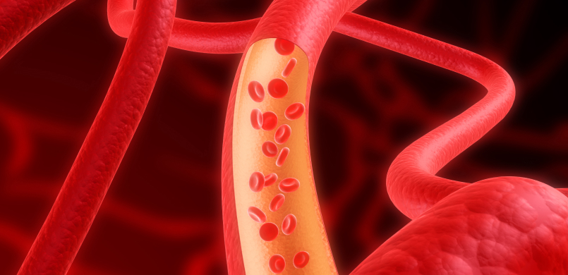 아르기닌 (혈행개선) 주사