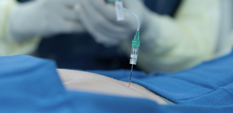 C-arm 유도하 주사 치료