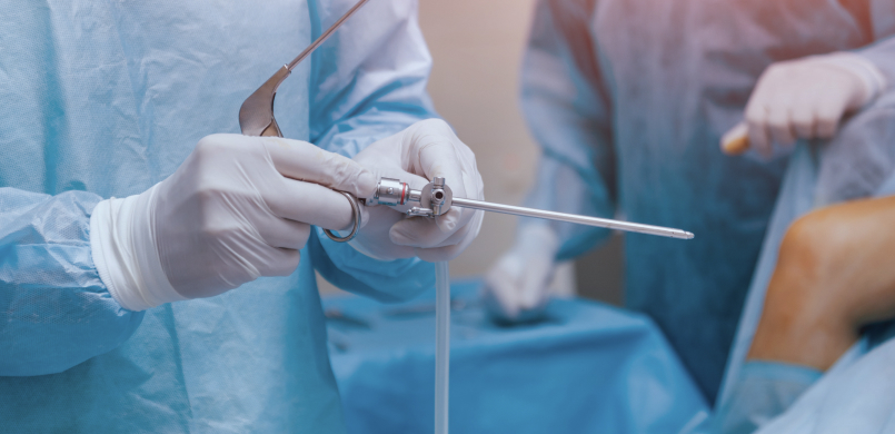 관절가동성형술(어깨)