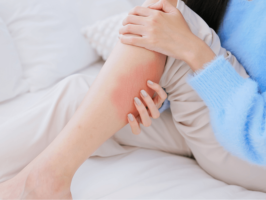 증상이 심한 경우