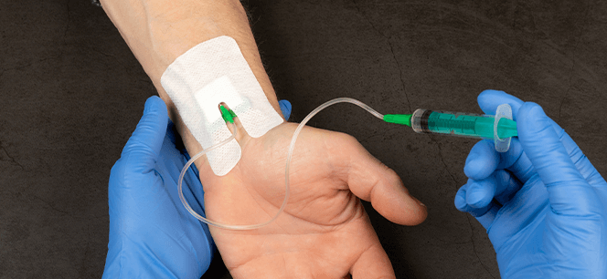 유전성 ・ 후천성