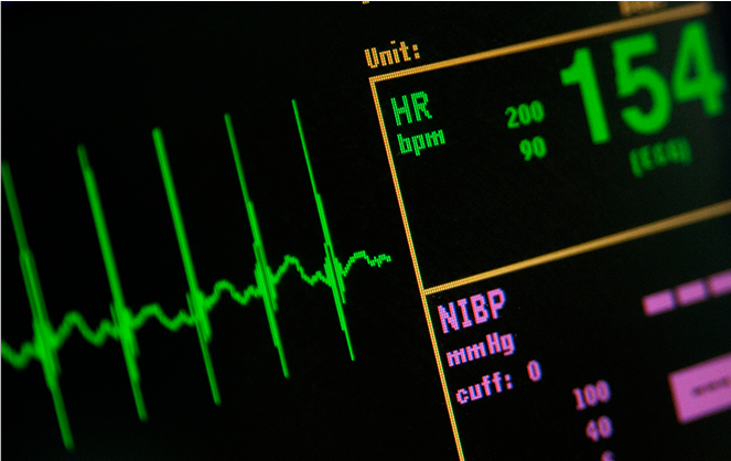 자율신경계(HRV)검사