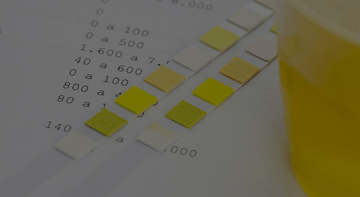 유기산 대사 균형 검사