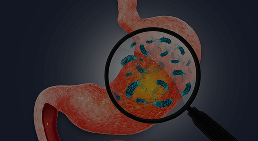 헬리코박터균 제균