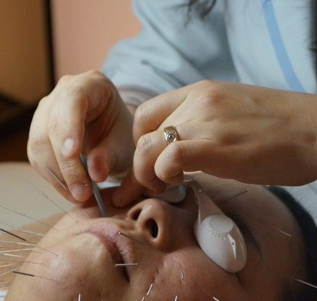 안면근육침 프로그램 소개