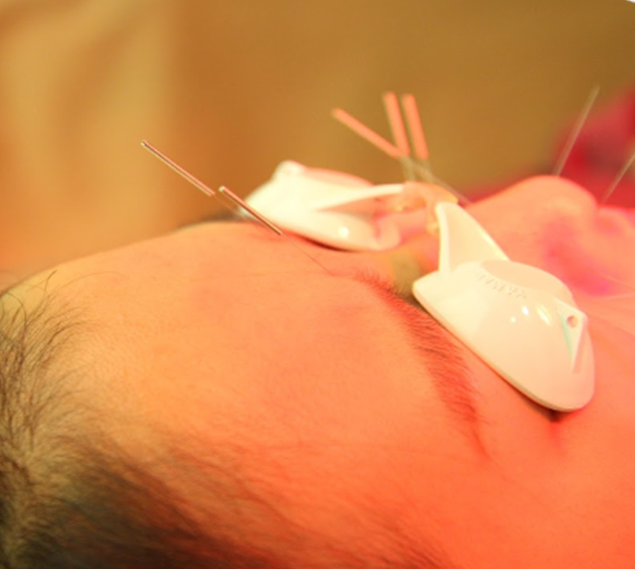 재생침 프로그램