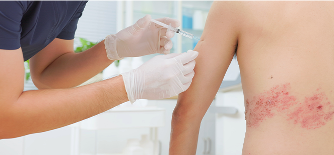 대상포진, 디스크 질환