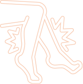 다리 저림, 근력 저하