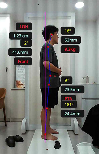 근골격 부정렬 검사